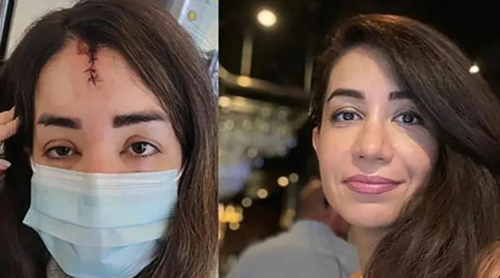 اخبار جدید درباره پرونده ربوده شدن الناز حاج تعمیری و منتشر شدن عکس چهره مجروح او