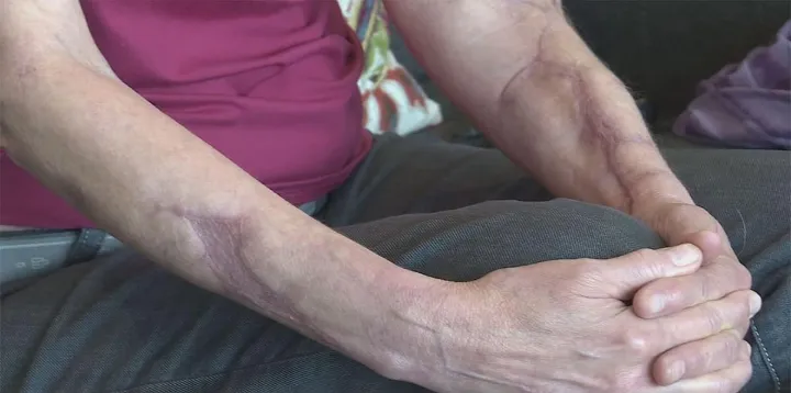 درخواست غرامت ۶۷۵ هزار دلاری بابت حمله سگ‌ها