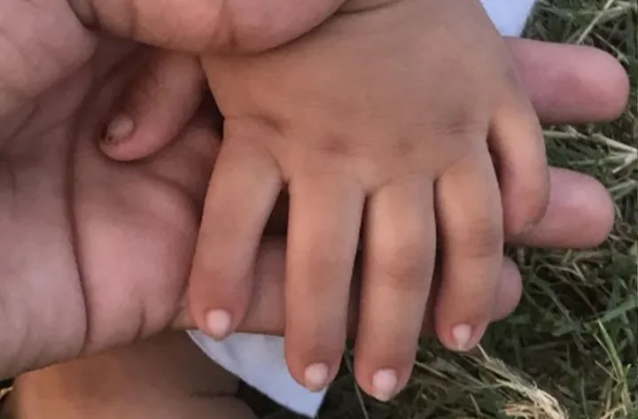 یافته‌های جالب دانشمندان: افراد یازده انگشتی دارای توانایی‌های بیشتری هستند!