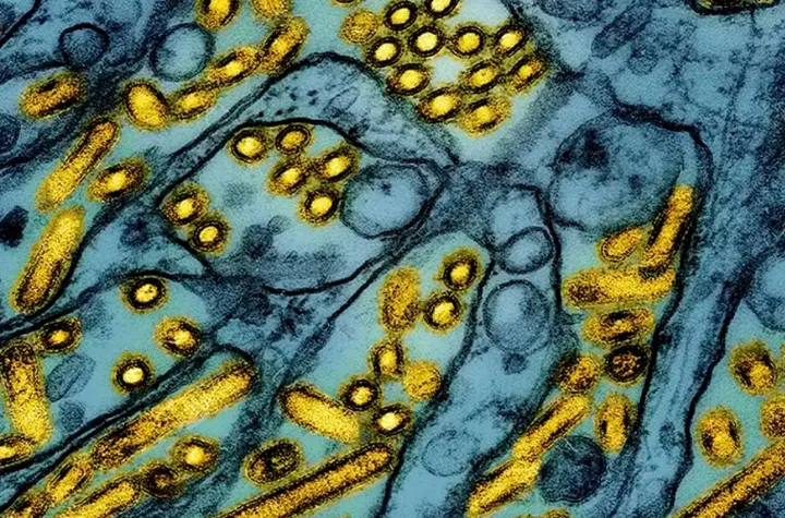 اولین مورد مشکوک ابتلای انسان به آنفلوانزای پرندگان در کانادا