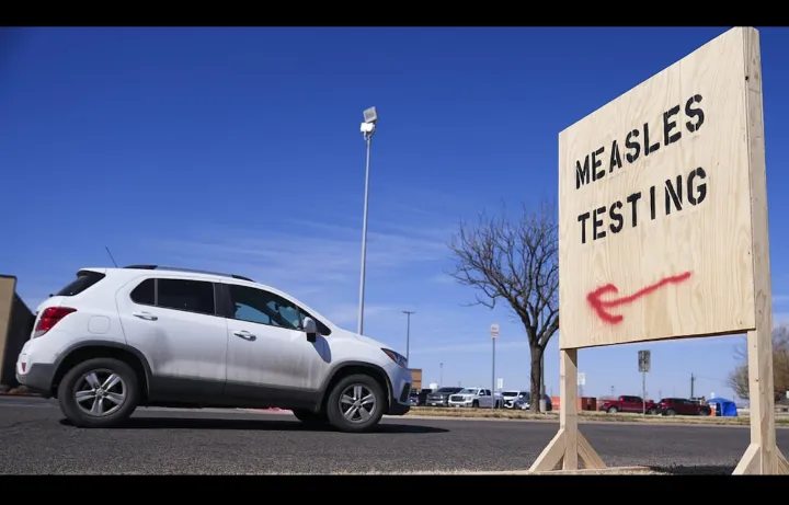 هشدار به کانادایی‌ها: سرخک در حال بازگشت، واکسن فراموش نشود